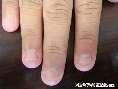 剪指甲、挖耳屎，这些日常小动作竟隐藏大危害！ - 天津生活资讯 - 天津28生活网 tj.28life.net